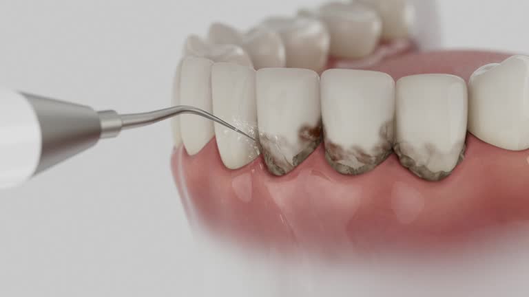 Reliable Dental Implants contractor in Kingstowne, VA by Smile Center Dentistry